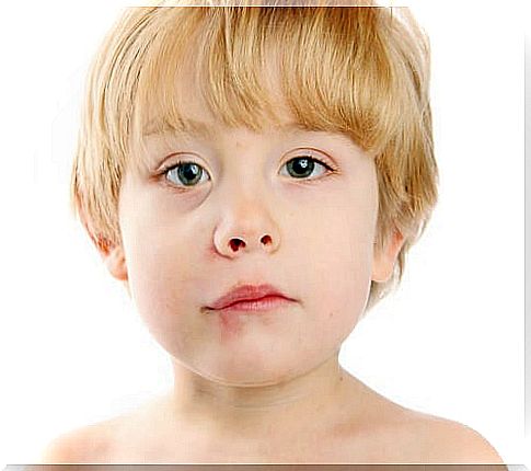 Mouth mouths in children: causes and treatment