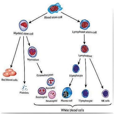 treatment for childhood leukemia